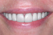 Case Study 1 After