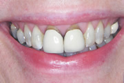 Case Study 1 Before