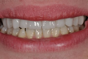 Case Study 2 After