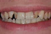 Case Study 2 Before
